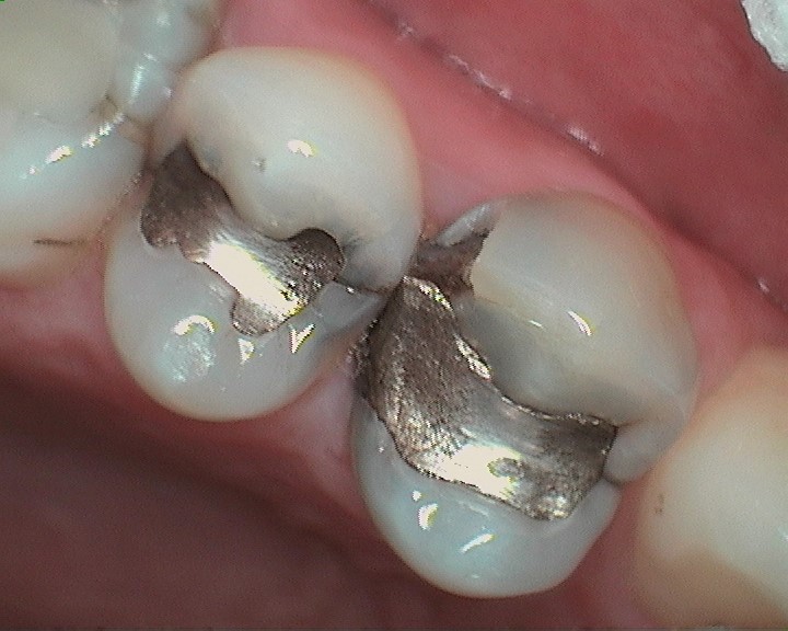 Before Image Before Image