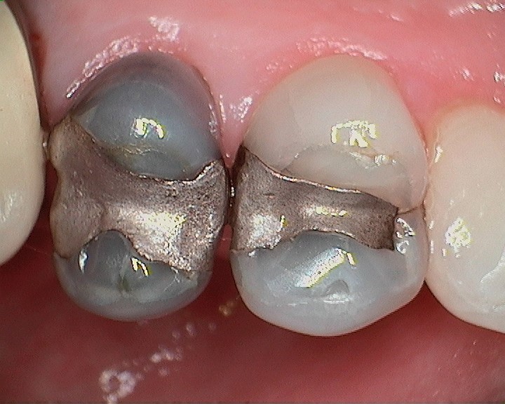 Before Image Before Image
