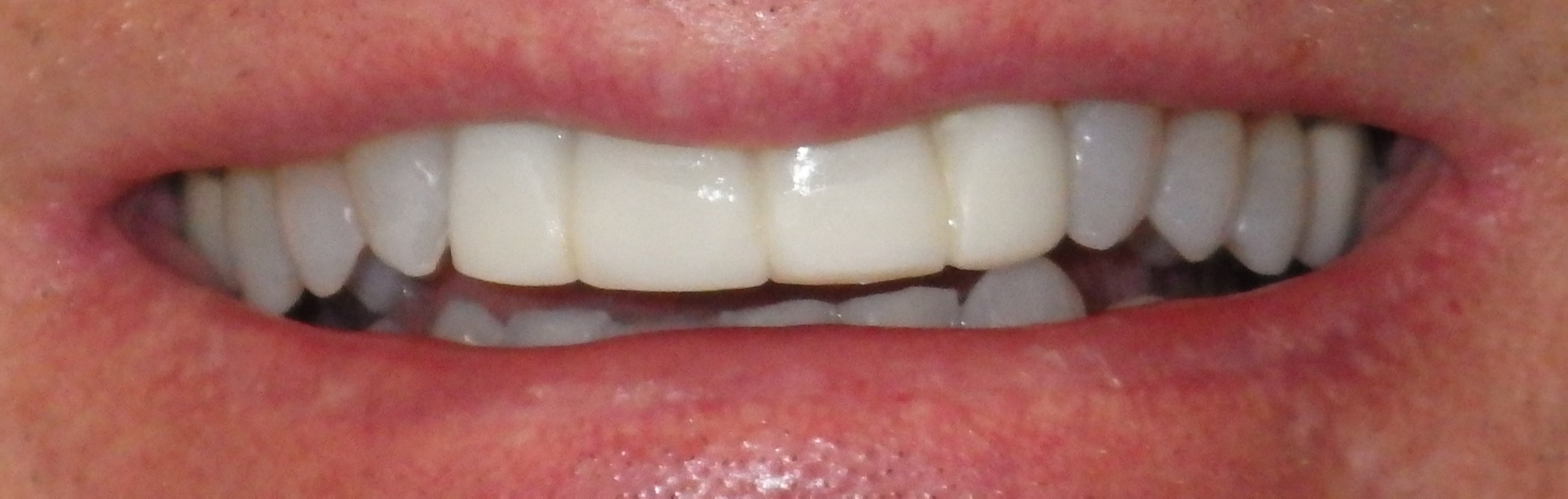 After Image After Image