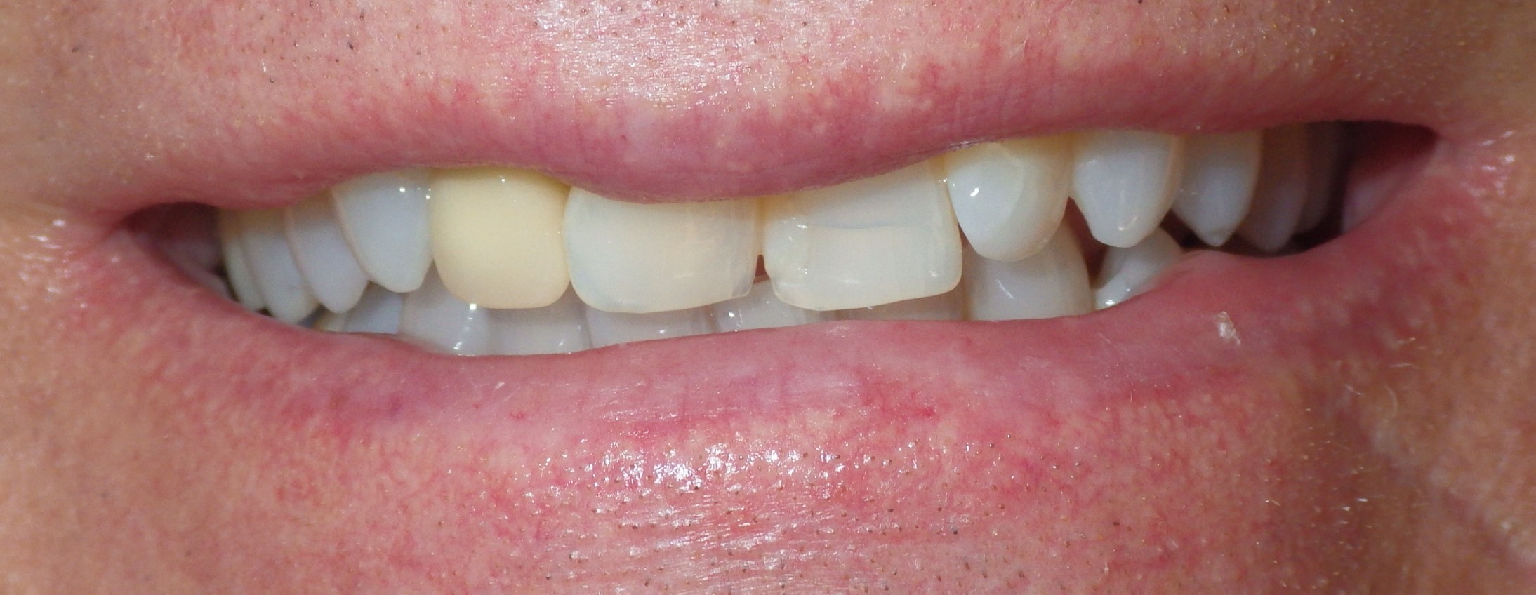 Before Image Before Image