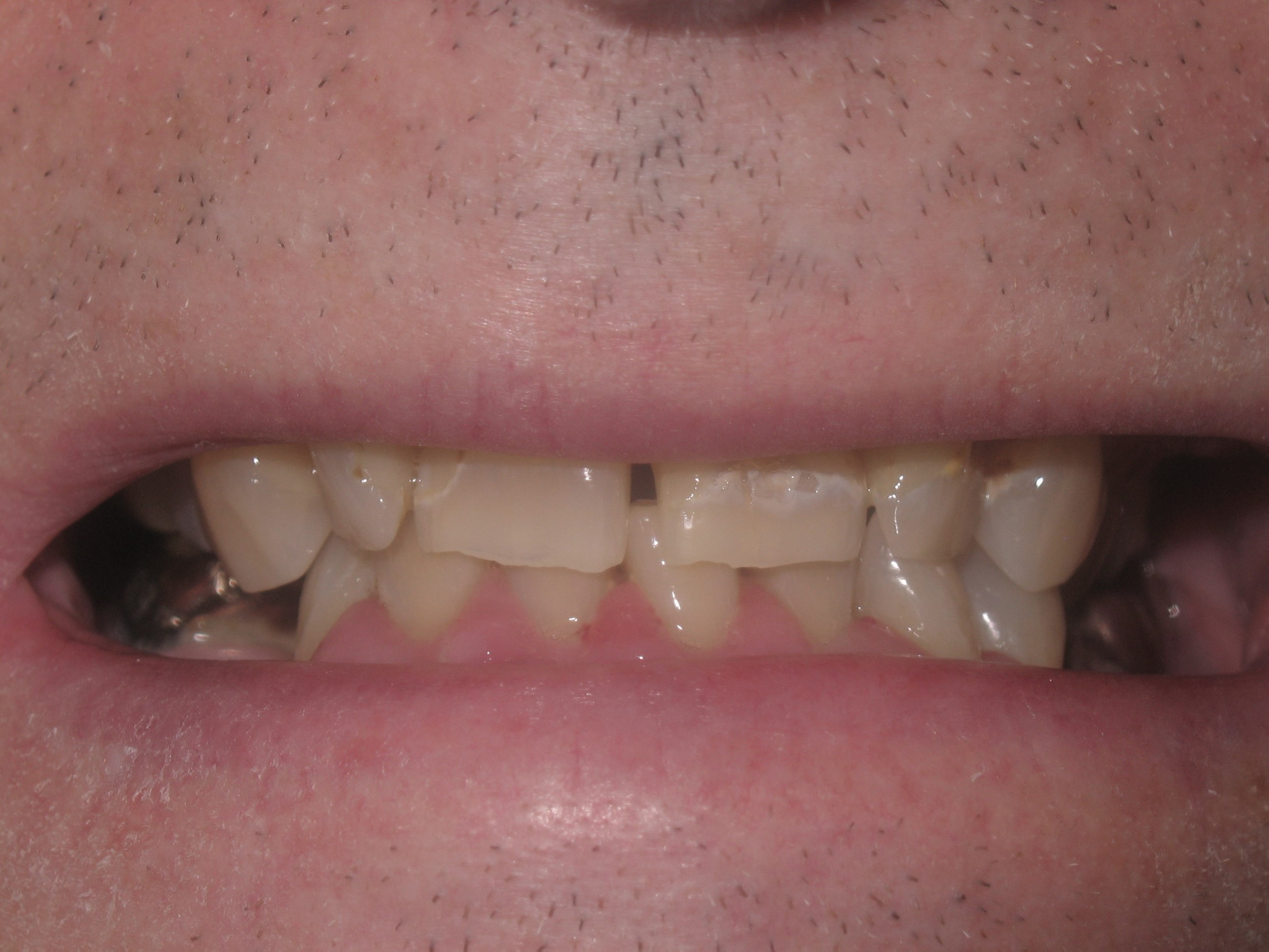 Before Image Before Image