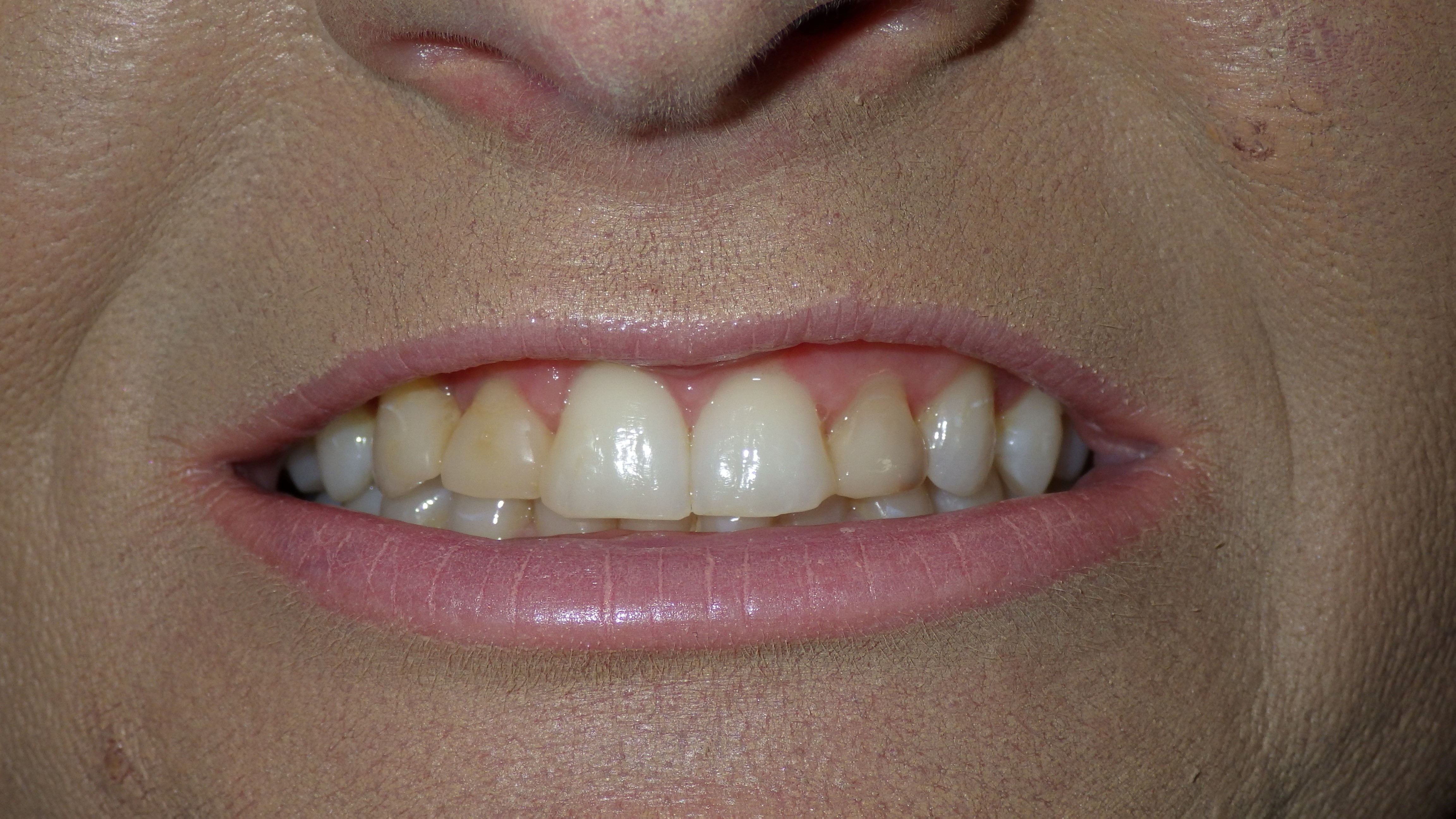 Before Image Before Image