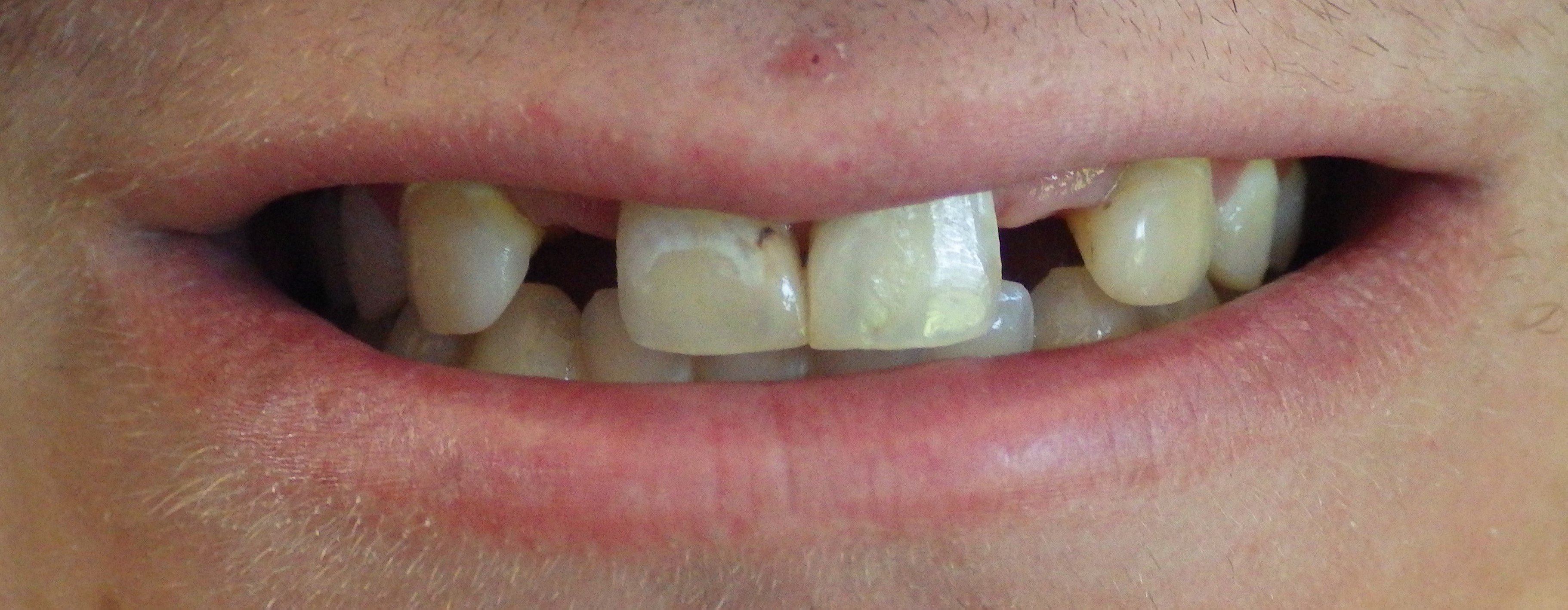 Before Image Before Image