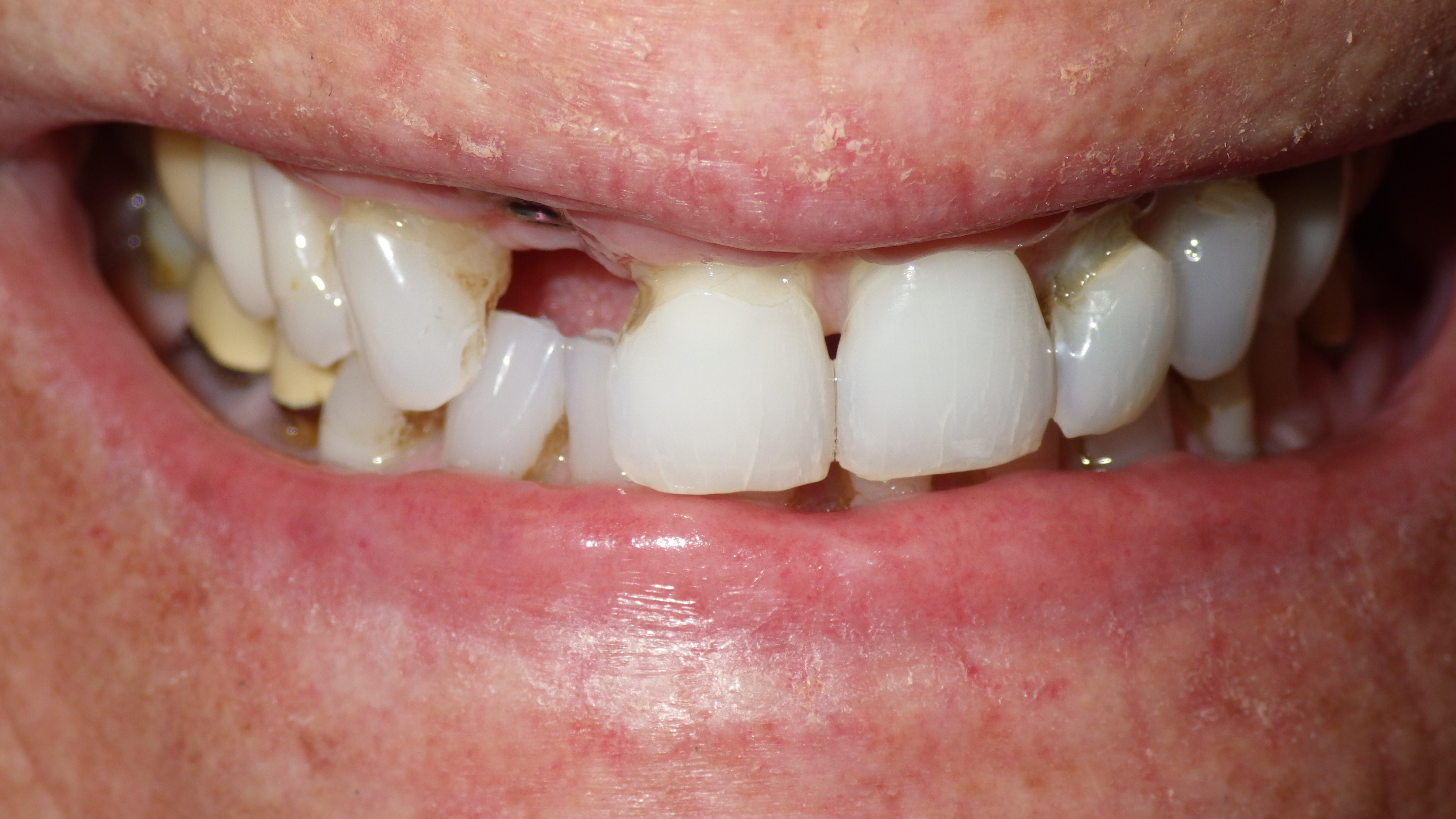 Before Image Before Image