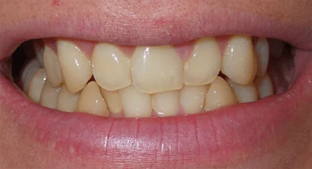Before Image Before Image