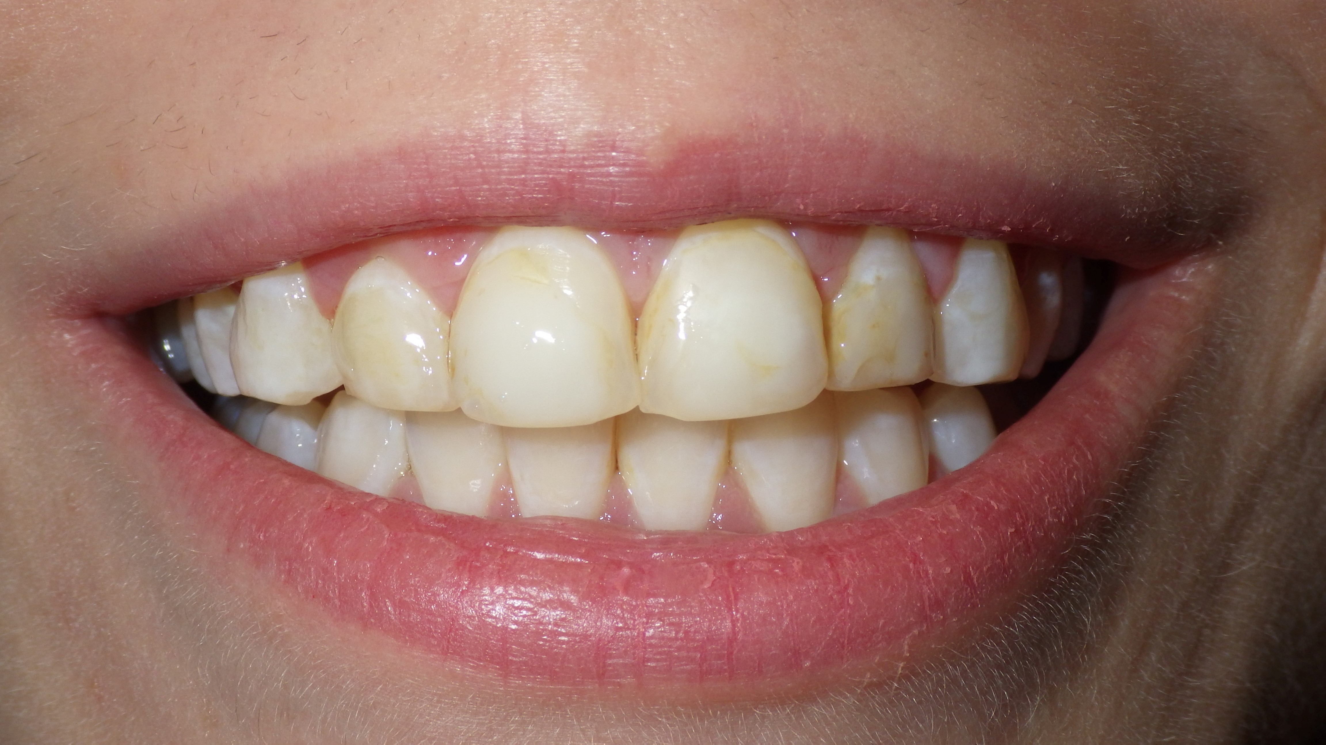 Before Image Before Image