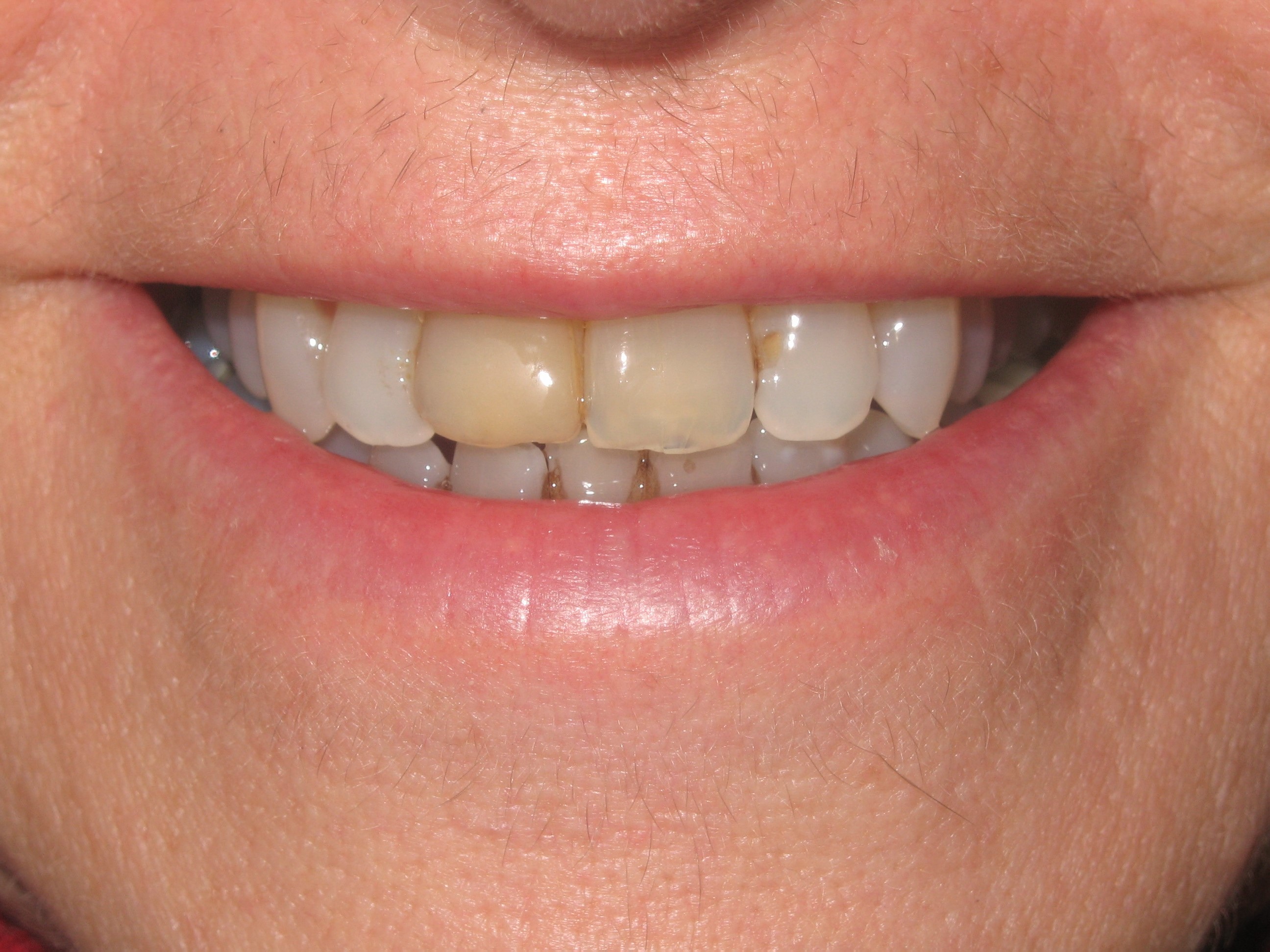 Before Image Before Image