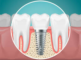 Rina Singh DDS Rina Singh DDS